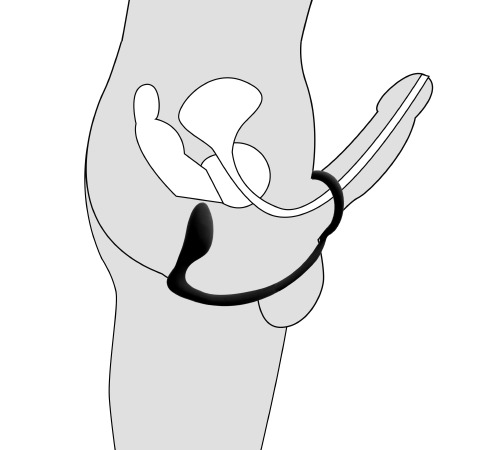 Анальный стимулятор массажер простаты с эрекционным кольцом
