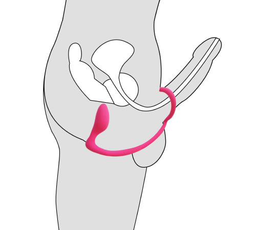 Анальный стимулятор массажер простаты с эрекционным кольцом
