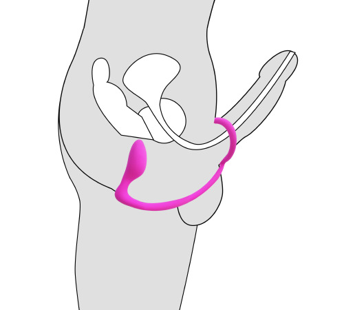 Анальный стимулятор массажер простаты с эрекционным кольцом